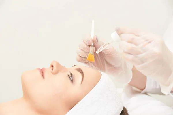Chemical Peel