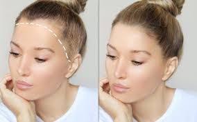 Hair Loss Treatment