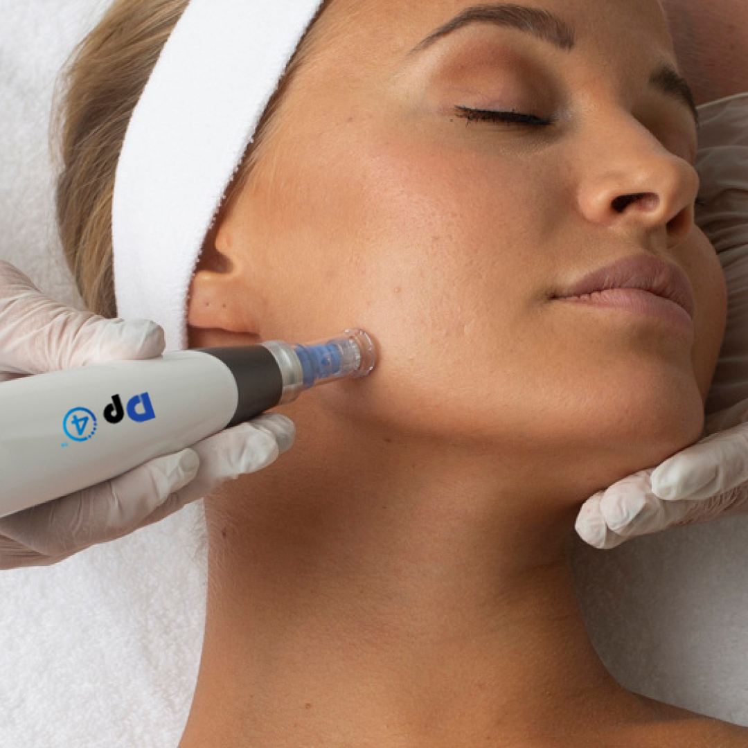 Microneedling